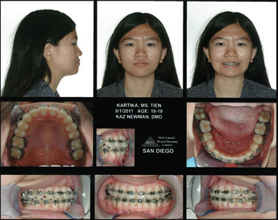 Smile Gallery Patient After